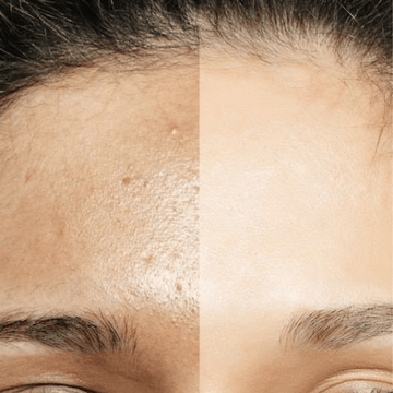 Dullness, Pigmentation & Uneven Tone - Alba Sole