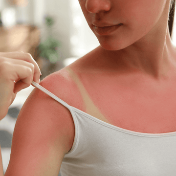 Sun Protection, Tanning & Pollution Defense - Alba Sole
